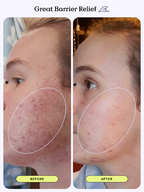 [ 店主自留 Pre-order ] Krave Beauty  Great Barrier Relief 45ml