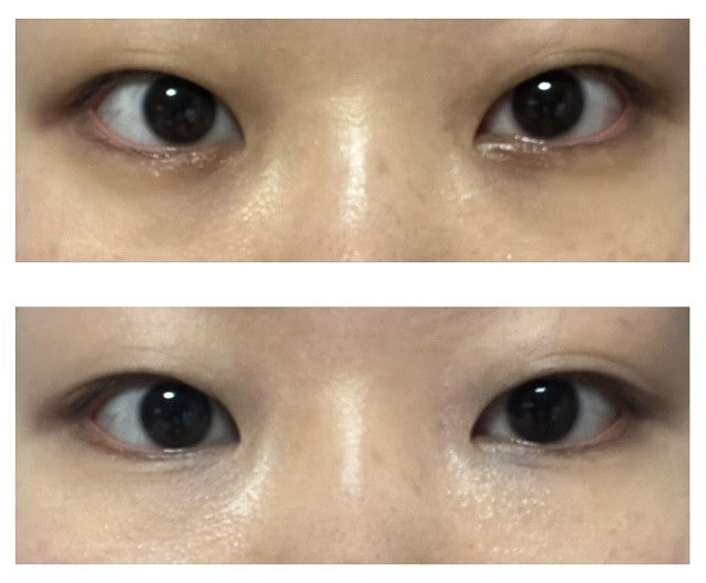 [ 店主推薦 - 現貨 ] Eyelenol 💚 保濕黑眼圈遮瑕眼霜 ( 乾肌偽素顏好物 )