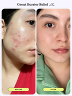 [ 店主自留 Pre-order ] Krave Beauty  Great Barrier Relief 45ml