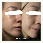 [ 現貨 ] Doctors 🩺 A醇安瓶/面霜👩🏻‍⚕️ ( 收毛孔/去暗粒 )