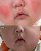 [ 現貨 ] Mongdies 100小時高保濕BB霜 Ato Balm 30g ( BB/孕婦都用得! )