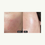 [ 現貨 ] Doctors 🩺 A醇安瓶/面霜👩🏻‍⚕️ ( 收毛孔/去暗粒 )