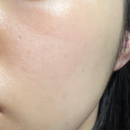 [ 來港中 ] Mongdies 100小時高保濕屏障潤膚霜 Ato Cream 240ml