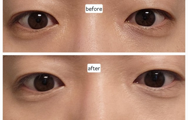 [ 店主推薦 - 現貨 ] Eyelenol 💚 保濕黑眼圈遮瑕眼霜 ( 乾肌偽素顏好物 )