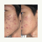 [ 現貨 ] Doctors 🩺 A醇安瓶/面霜👩🏻‍⚕️ ( 收毛孔/去暗粒 )