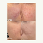 [ 現貨 ] Doctors 🩺 A醇安瓶/面霜👩🏻‍⚕️ ( 收毛孔/去暗粒 )