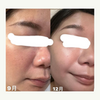 [ 現貨 ] Doctors 🩺 A醇安瓶/面霜👩🏻‍⚕️ ( 收毛孔/去暗粒 )