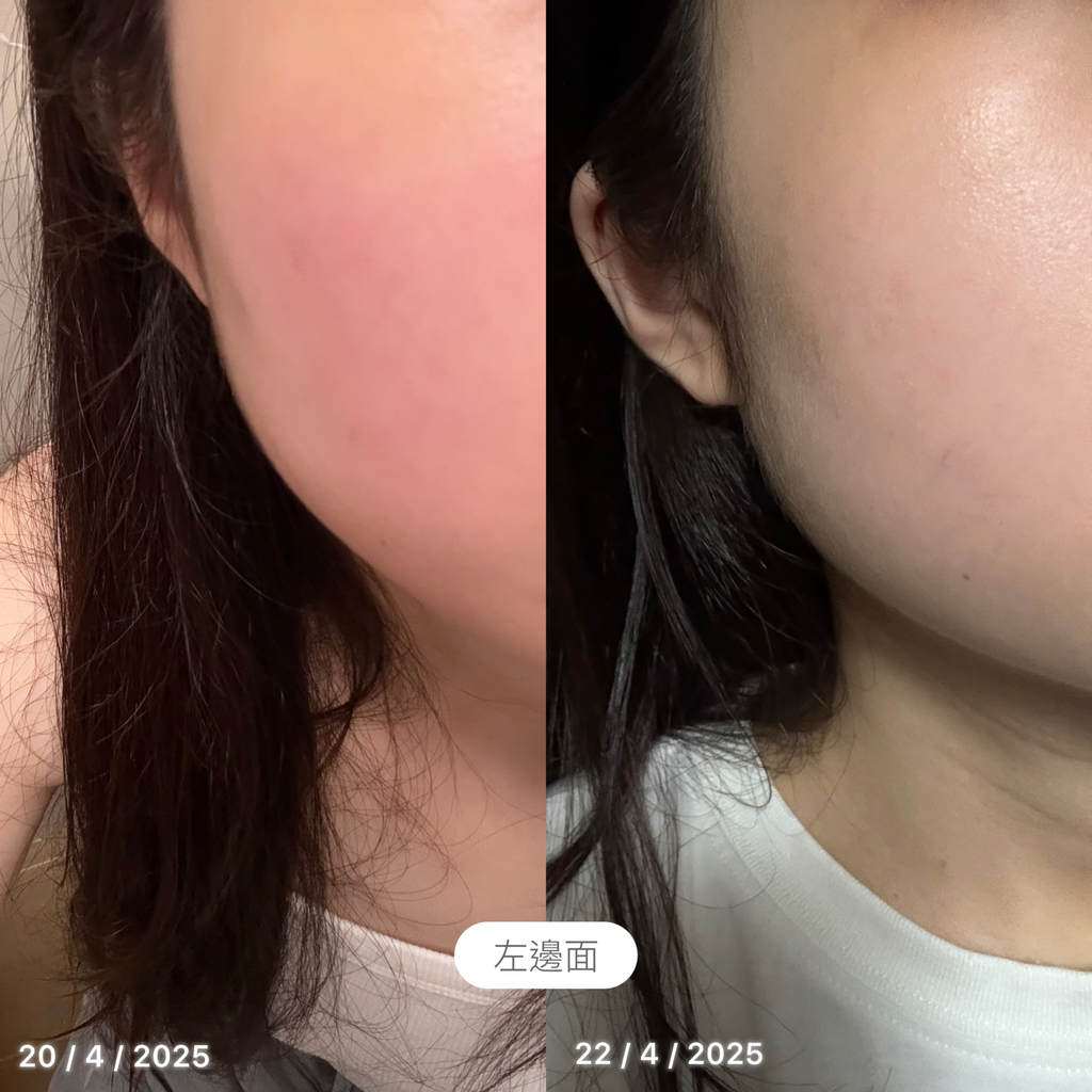 [ 來港中 ] Mongdies 100小時高保濕屏障潤膚霜 Ato Cream 240ml