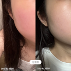 [ 現貨 ] 🇰🇷韓國皮膚科 Cutem 薰衣草舒敏保濕B5精華水 150ml ( 可妝前使用 )