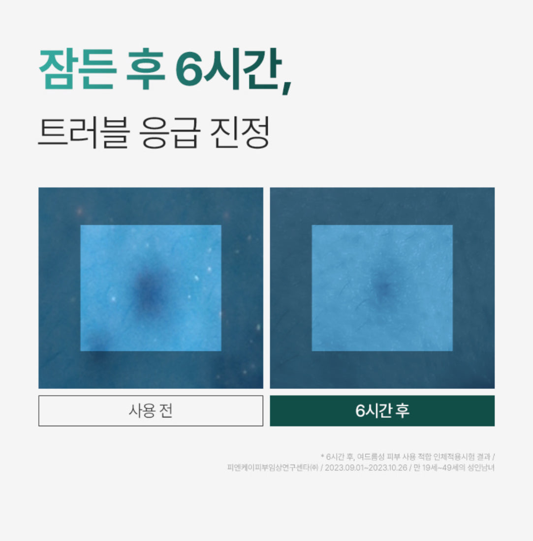 [ Pre-order ] P.calm 溫和袪痘消炎霜 Centella Trouble Spot ( 適合乾肌使用 )