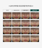 [ Pre-order ] P.calm 溫和袪痘消炎霜 Centella Trouble Spot ( 適合乾肌使用 )