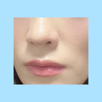 [ 店主推薦 - 現貨 ] Oddtype ✨ 高光水光棒  Unveiled Skin Highlighter 11g