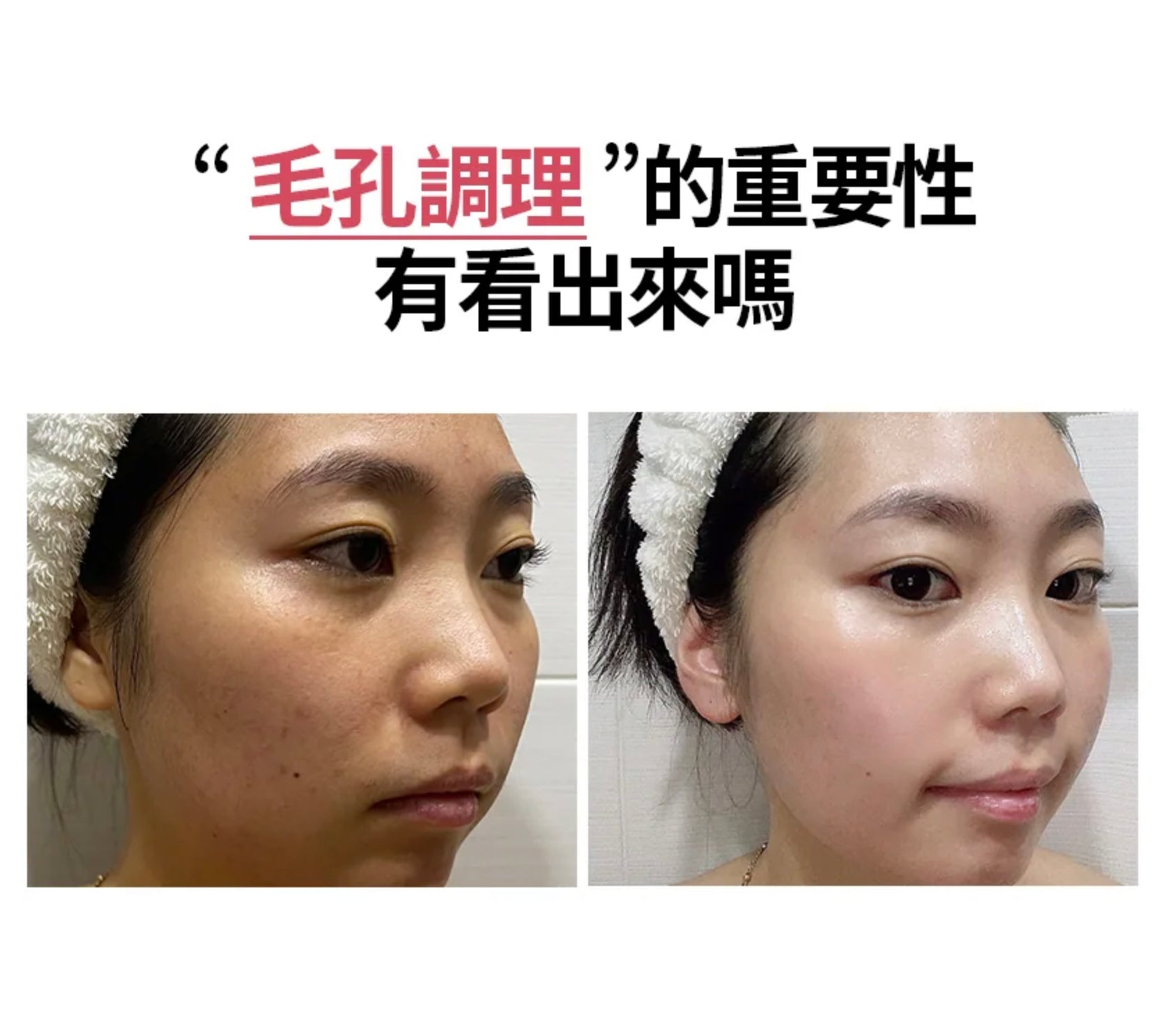 [ Pre-order ] Milk Touch❤️維他命精華膠囊亮白洗面乳 ( 乾肌/油肌都啱用👍🏻 )