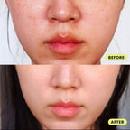 [ 店主自留 Pre-order ] Krave Beauty  Great Barrier Relief 45ml